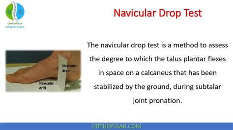 navicular drop test technique